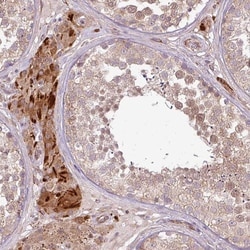 PDRG1 Polyclonal Antibody:Antibodies, Polyclonal