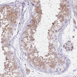 RPL39L Polyclonal Antibody:Antibodies, Polyclonal