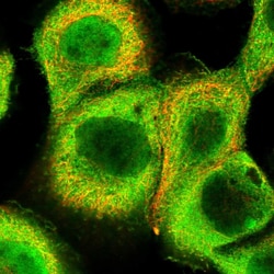 Invitrogen NSFL1C Polyclonal Antibody 100 &mu;L | Buy Online | Invitrogen&trade; | Fisher Scientific