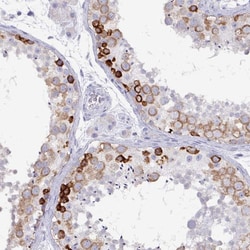 Invitrogen DAZ1 Polyclonal Antibody 100 &mu;L; Unconjugated:Antibodies,