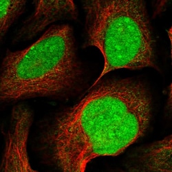 Invitrogen XRN2 Polyclonal Antibody 100 &mu;L; Unconjugated:Antibodies,