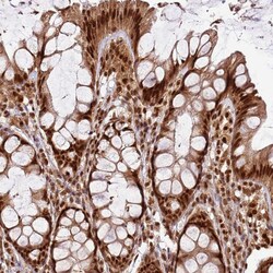 Invitrogen XRN2 Polyclonal Antibody 100 &mu;L; Unconjugated:Antibodies,