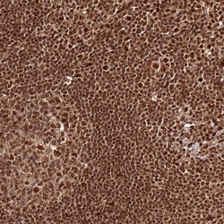 Invitrogen XRN2 Polyclonal Antibody 100 &mu;L; Unconjugated:Antibodies,