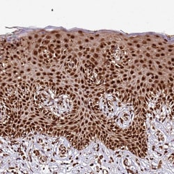 Invitrogen XRN2 Polyclonal Antibody 100 &mu;L; Unconjugated:Antibodies,