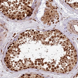 Invitrogen XRN2 Polyclonal Antibody 100 &mu;L; Unconjugated:Antibodies,