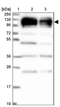 Invitrogen XRN2 Polyclonal Antibody 100 &mu;L | Buy Online | Invitrogen&trade; | Fisher Scientific