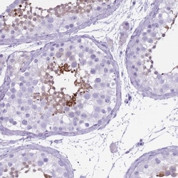 Invitrogen OR7C1 Polyclonal Antibody 100 &mu;L; Unconjugated:Antibodies,
