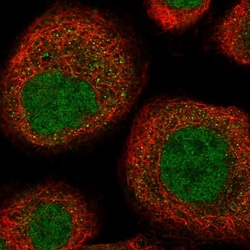 Invitrogen UEVLD Polyclonal Antibody 100 &mu;L; Unconjugated:Antibodies,