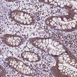 Invitrogen UEVLD Polyclonal Antibody 100 &mu;L; Unconjugated:Antibodies,