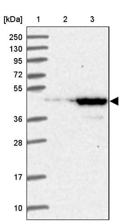 Invitrogen UEVLD Polyclonal Antibody 100 &mu;L; Unconjugated:Antibodies,
