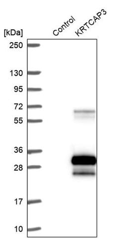 Invitrogen KRTCAP3 Polyclonal Antibody 100 &mu;L; Unconjugated:Antibodies,