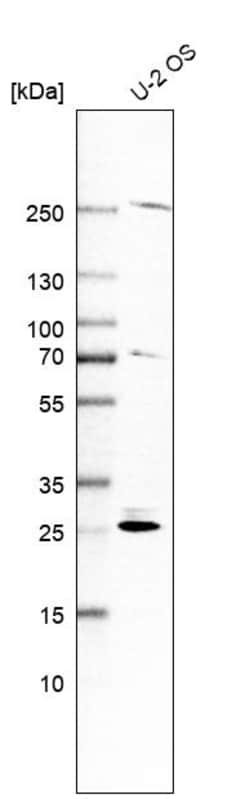 Invitrogen SPC25 Polyclonal Antibody 100 &mu;L; Unconjugated:Antibodies,
