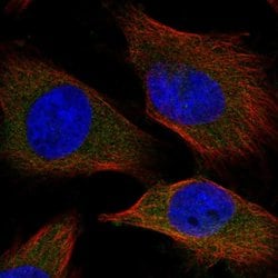 Invitrogen SPC25 Polyclonal Antibody 100 &mu;L; Unconjugated:Antibodies,