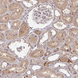 Invitrogen MRPS17 Polyclonal Antibody 100 &mu;L; Unconjugated:Antibodies,
