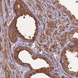 DDX59 Polyclonal Antibody:Antibodies, Polyclonal