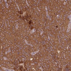 MRRF Polyclonal Antibody, Invitrogen&trade;