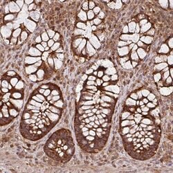MRRF Polyclonal Antibody, Invitrogen™