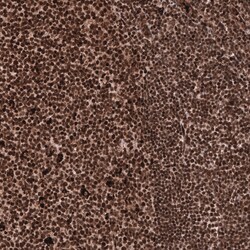 Invitrogen PTMA Polyclonal Antibody 100 &mu;L; Unconjugated:Antibodies,