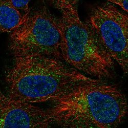 DKKL1 Polyclonal Antibody:Antibodies, Polyclonal
