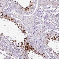 DKKL1 Polyclonal Antibody:Antibodies, Polyclonal