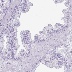 DKKL1 Polyclonal Antibody:Antibodies, Polyclonal