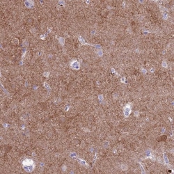 Invitrogen PDE10A Polyclonal Antibody 100 &mu;L; Unconjugated:Antibodies,