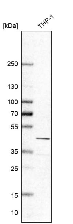 Invitrogen Galectin 9 Polyclonal Antibody 100 &mu;L; Unconjugated:Antibodies,