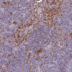 Invitrogen Galectin 9 Polyclonal Antibody 100 &mu;L; Unconjugated:Antibodies,