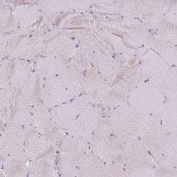 Invitrogen Galectin 9 Polyclonal Antibody 100 &mu;L; Unconjugated:Antibodies,