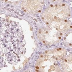Invitrogen PPP1R10 Polyclonal Antibody 100 &mu;L; Unconjugated:Antibodies,