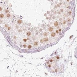 Invitrogen PPP1R10 Polyclonal Antibody 100 &mu;L; Unconjugated:Antibodies,