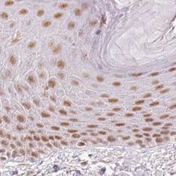 Invitrogen PPP1R10 Polyclonal Antibody 100 &mu;L; Unconjugated:Antibodies,