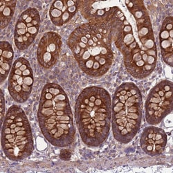 Invitrogen RPL21 Polyclonal Antibody 100 &mu;L; Unconjugated:Antibodies,