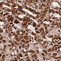 Invitrogen TMEM200C Polyclonal Antibody 100 &mu;L; Unconjugated:Antibodies,