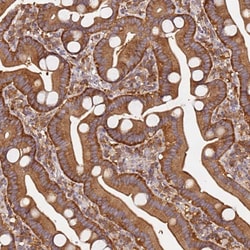 Invitrogen PIH1D1 Polyclonal Antibody 100 &mu;L | Buy Online | Invitrogen&trade; | Fisher Scientific