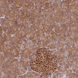 Invitrogen PIH1D1 Polyclonal Antibody 100 &mu;L | Buy Online | Invitrogen&trade; | Fisher Scientific