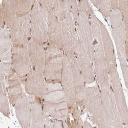 Invitrogen PIH1D1 Polyclonal Antibody 100 &mu;L | Buy Online | Invitrogen&trade; | Fisher Scientific