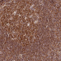 Invitrogen PIH1D1 Polyclonal Antibody 100 &mu;L | Buy Online | Invitrogen&trade; | Fisher Scientific