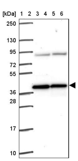 Invitrogen PIH1D1 Polyclonal Antibody 100 &mu;L | Buy Online | Invitrogen&trade; | Fisher Scientific