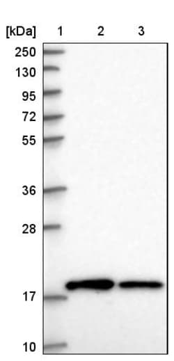 Invitrogen RPS10 Polyclonal Antibody 100 &mu;L; Unconjugated:Antibodies,