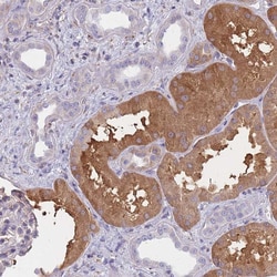 Invitrogen OR7C2 Polyclonal Antibody 100 &mu;L; Unconjugated:Antibodies,