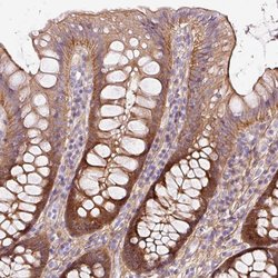 SOS2 Polyclonal Antibody:Antibodies, Polyclonal
