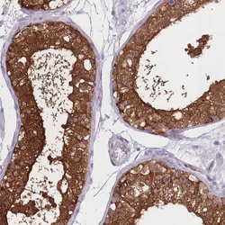 Invitrogen OR11H1 Polyclonal Antibody 100 &mu;L; Unconjugated:Antibodies,