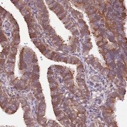 Invitrogen SCARA3 Polyclonal Antibody 100 &mu;L; Unconjugated:Antibodies,