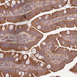 Invitrogen SCARA3 Polyclonal Antibody 100 &mu;L; Unconjugated:Antibodies,