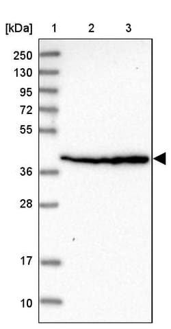 Invitrogen SCARA3 Polyclonal Antibody 100 &mu;L | Buy Online | Invitrogen&trade; | Fisher Scientific
