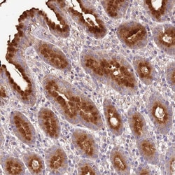 Invitrogen EXD3 Polyclonal Antibody 100 &mu;L; Unconjugated:Antibodies,