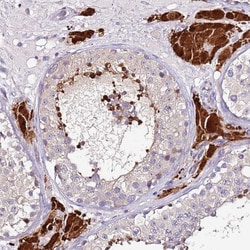 Invitrogen SRRM5 Polyclonal Antibody 100 &mu;L; Unconjugated:Antibodies,