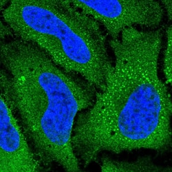 Invitrogen SLC38A5 Polyclonal Antibody 100 &mu;L; Unconjugated:Antibodies,