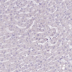 Invitrogen SLC38A5 Polyclonal Antibody 100 &mu;L; Unconjugated:Antibodies,